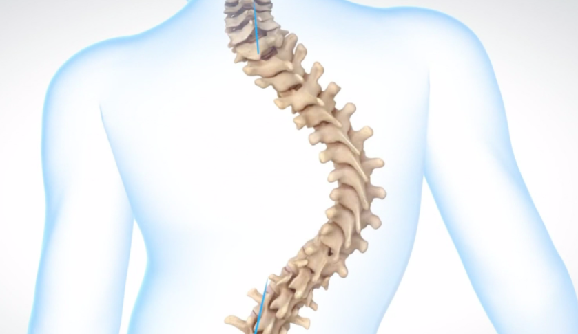 Magic magnets for spinal lengthening - Channing