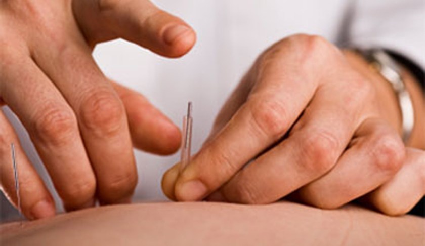 Acupuncture. (CBS News photo)