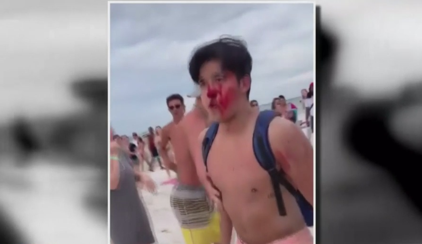 Spring breaker wounded following a fight with security. (Credit: WINK News)