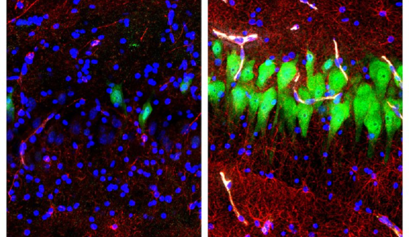 This combination of images provided by the Yale School of Medicine in April 2019 shows stained microscope photos of neurons, green; astrocytes, red, and cell nuclei, blue, from a pig brain left untreated for 10 hours after death, left, and another with a specially designed blood substitute pumped through it. By medical standards “this is not a living brain,” said Nenad Sestan of the Yale School of Medicine, one of the researchers reporting the results Wednesday, April 17, 2019, in the journal Nature. But the work revealed a surprising degree of resilience within a brain that has lost its supply of blood and oxygen, he said. (Stefano G. Daniele, Zvonimir Vrselja/Sestan Laboratory/Yale School of Medicine)