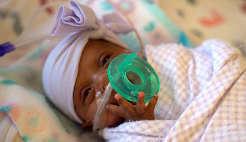 This March, 2019 photo provided by Sharp HealthCare in San Diego shows a baby named Saybie. Sharp Mary Birch Hospital for Women & Newborns said in a statement Wednesday, May 29, 2019, that Saybie, born at 23 weeks and three days, is believed to be the world's tiniest surviving baby, who weighed just 245 grams (about 8.6 ounces) before she was discharged as a healthy infant. She was sent home this month weighing 5 pounds (2 kilograms) after nearly five months in the hospital's neonatal intensive care unit. (Sharp HealthCare via AP)