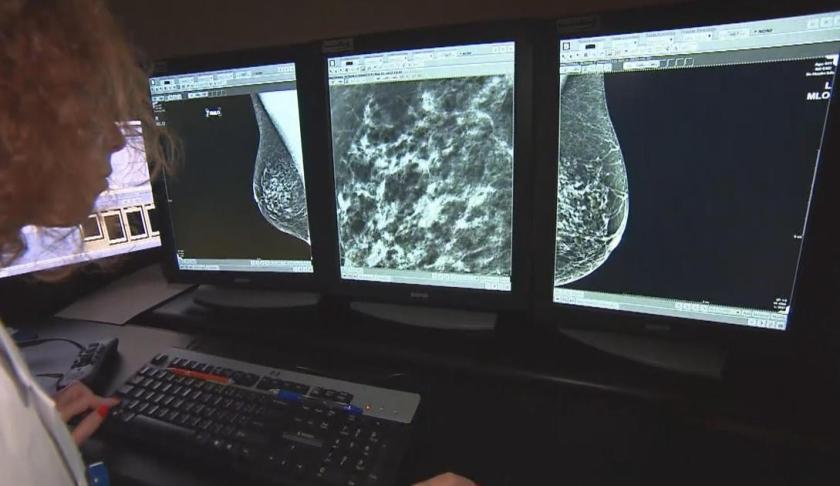 A new drug could be a game changer in the battle against breast cancer. (Credit: CBS News)