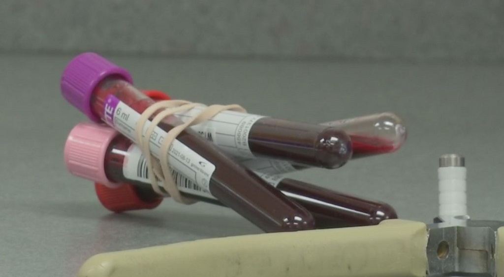 Use Of Plasma To Fight COVID 19 Declining WINK News   Plasma Donation 