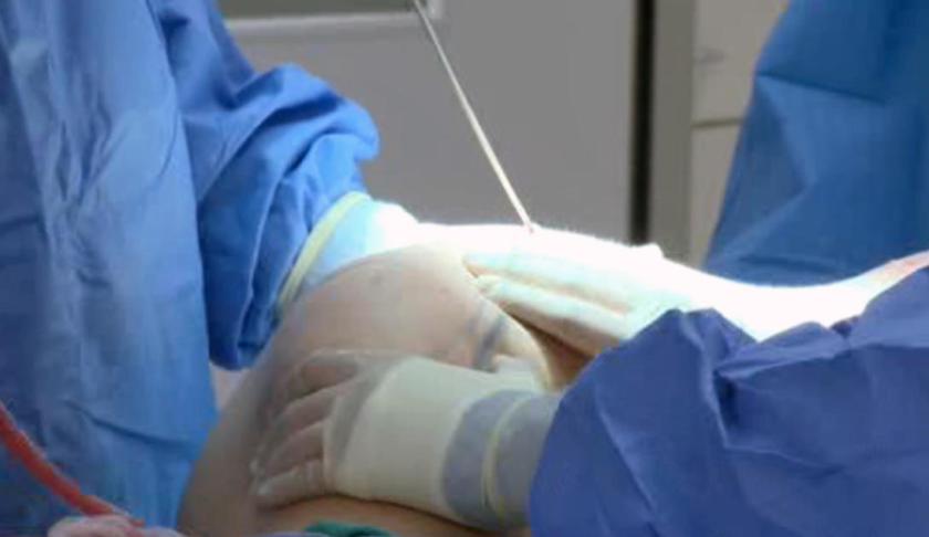 Seven plastic surgeons are asking an appeals court to block a new state emergency rule that placed additional restrictions on the procedure known as the Brazilian butt lift.