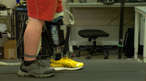 prosthetic ankles