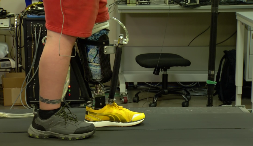 prosthetic ankles