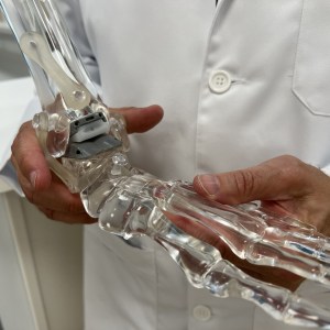 New technology helps arthritis patients walk again