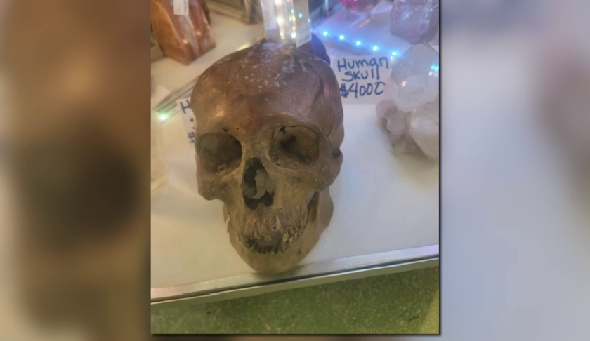 human skull