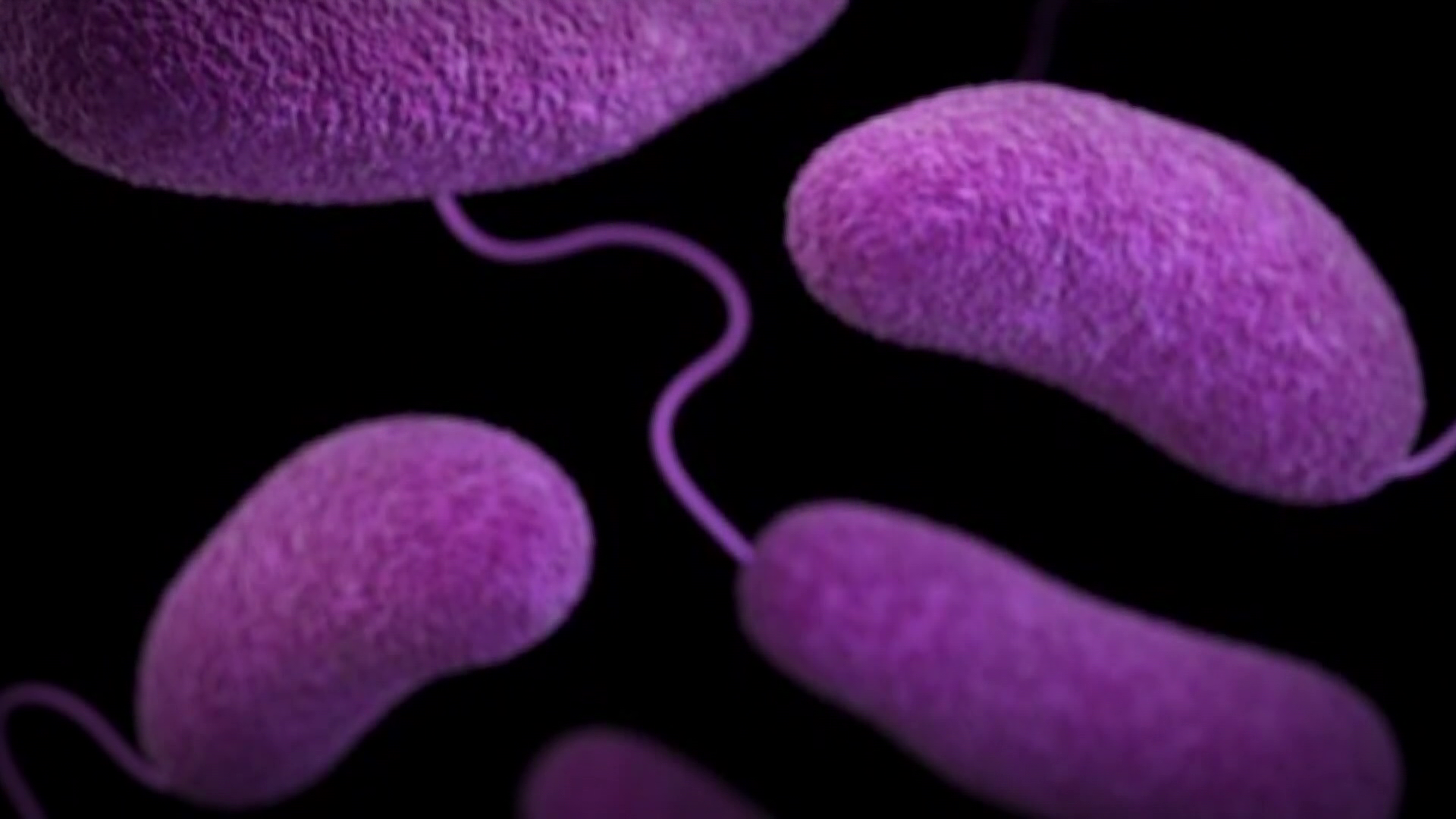 Spike in flesh-eating bacteria cases concerning Floridians