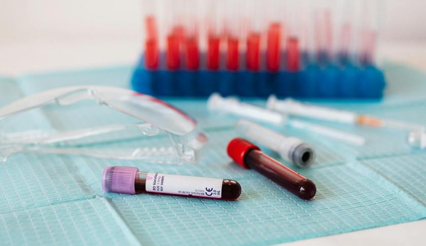 full vials of blood near various medical equipment for taking blood